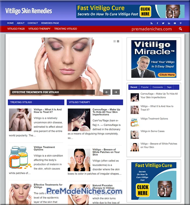 ready made vitiligo website