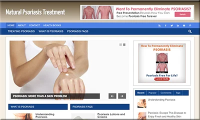 Premade Psoriasis Treatment Site with Amazing Theme