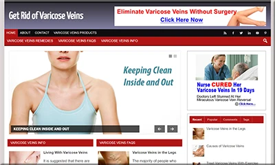 Pre-made Varicose Veins Blog You Need to Download