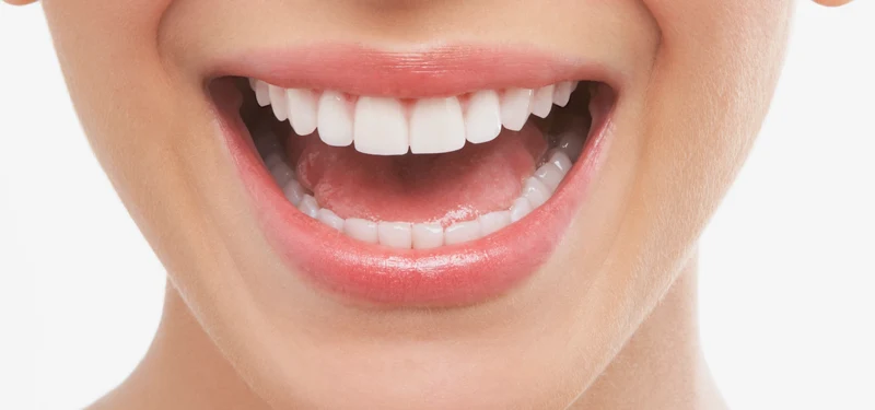 Teeth Whitening Secrets