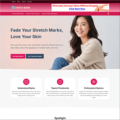 Ready Made Stretch Mark Treatment Website Template