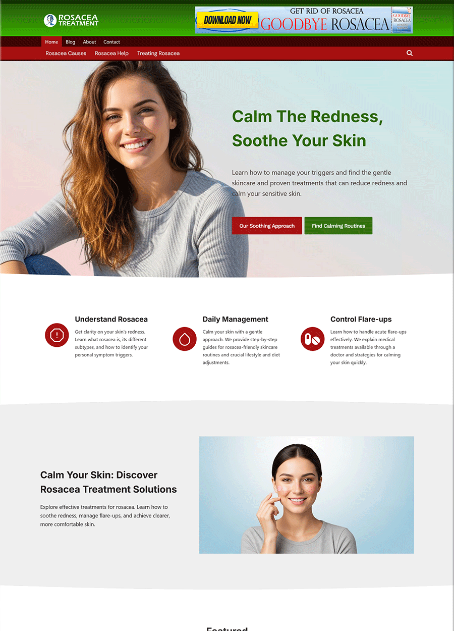 Soothing Rosacea Treatment Website Template Screenshot of a ready-to-go website for soothing rosacea treatment.
